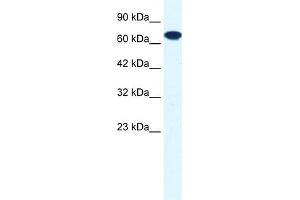 WB Suggested Anti-ZNF179 Antibody Titration:  0.