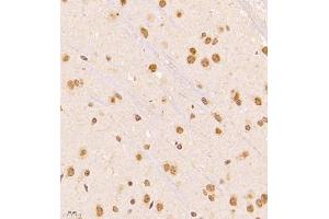 Immunohistochemistry (Paraffin-embedded Sections) (IHC (p)) image for anti-Nuclear Apoptosis Inducing Factor 1 (NAIF1) antibody (ABIN7074867)