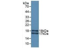 Detection of Recombinant CEACAM1, Rat using Polyclonal Antibody to Carcinoembryonic Antigen Related Cell Adhesion Molecule 1 (CEACAM1) (CEACAM1 抗体  (AA 36-145))