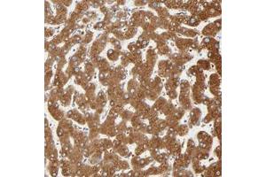 Immunohistochemical staining of human liver with MAGEB17 polyclonal antibody  shows strong cytoplasmic positivity in hepatocyte at 1:50-1:200 dilution. (MAGEB17 抗体)