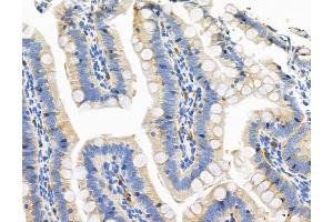 ABIN6266329 and ABIN6276659 at 1/100 staining Rat colon tissue by IHC-P. (CD44 抗体  (Internal Region))