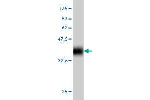 Western Blotting (WB) image for anti-Spermatogenesis Associated 2 (SPATA2) (AA 422-519) antibody (ABIN564236)