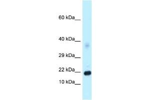 Host: Rabbit Target Name: Dkk4 Antibody Dilution: 1. (DKK4 抗体  (C-Term))