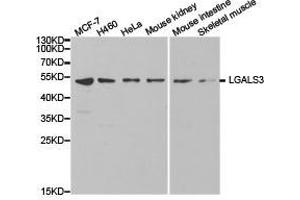 Western Blotting (WB) image for anti-Galectin 3 (LGALS3) antibody (ABIN1873541) (Galectin 3 抗体)
