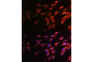 Immunofluorescence analysis of C6 cells using Neurofilament H Rabbit pAb (ABIN6129638, ABIN6144512, ABIN6144513 and ABIN6224502) at dilution of 1:100 (40x lens). (NEFH 抗体  (AA 821-1020))