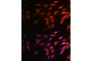 Immunofluorescence analysis of C6 cells using Neurofilament H Rabbit pAb (ABIN6129638, ABIN6144512, ABIN6144513 and ABIN6224502) at dilution of 1:100 (40x lens). (NEFH 抗体  (AA 821-1020))