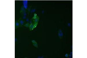 Immunofluorescence analysis on ETAR protein fused with 9A2 epitope tag. (HCV 1b NS5B 抗体  (AA 111-130))
