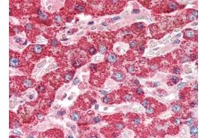 Human Liver (formalin-fixed, paraffin-embedded) stained with CTSDat 10 µg/ml followed by biotinylated goat anti-rabbit IgG secondary antibody, alkaline phosphatase-streptavidin and chromogen. (Cathepsin D 抗体)