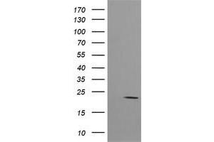 Image no. 2 for anti-HRas proto-oncogene, GTPase (HRAS) antibody (ABIN1498716) (HRAS 抗体)