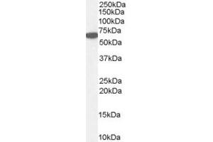 ABIN185651 (1µg/ml) staining of Human Kidney lysate (35µg protein in RIPA buffer). (Catalase 抗体  (Internal Region))