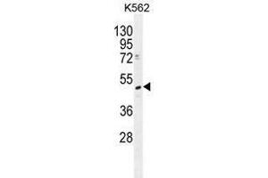 TRMT2B Antibody (N-term) western blot analysis in K562 cell line lysates (35 µg/lane). (TRMT2B 抗体  (N-Term))