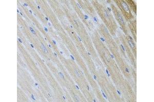 Immunohistochemistry of paraffin-embedded Mouse heart using USP25 Polyclonal Antibody at dilution of 1:100 (40x lens). (USP25 抗体)