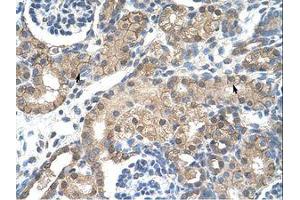 anti-Cholinergic Receptor, Nicotinic, beta 2 (Neuronal) (CHRNB2) (AA 155-204) antibody