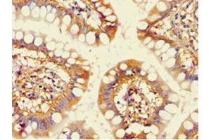 Immunohistochemistry of paraffin-embedded human small intestine tissue using ABIN7143191 at dilution of 1:100 (ACAD9 抗体  (AA 1-270))