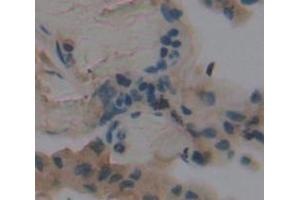 Used in DAB staining on fromalin fixed paraffin- embedded lung tissue (FADS3 抗体  (AA 331-445))