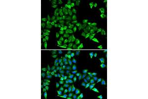 Immunofluorescence analysis of HeLa cells using CST3 antibody. (CST3 抗体)