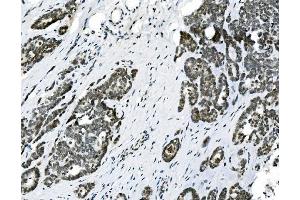 IHC analysis of HOXD11 using anti-HOXD11 antibody (ABIN7603174). (HOXD11 抗体  (N-Term))