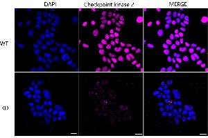 Immunocytochemical staining of Hela cells using Checkpoint kinase 2 antibody (ABIN7798040), 1:1,000), Top panel: wild-type (WT), Bottom panal: Checkpoint kinase 2 shRNA knockdown (KD). (Recombinant CHEK2 抗体)