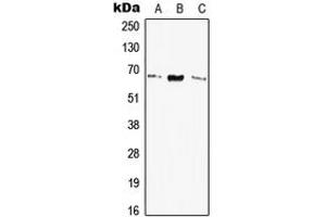 Western blot analysis of Elastin expression in HEK293T (A), SP2/0 (B), H9C2 (C) whole cell lysates. (Elastin 抗体  (Center))