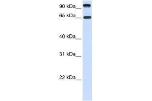 NTRK3 antibody used at 1 ug/ml to detect target protein. (NTRK3 抗体  (C-Term))