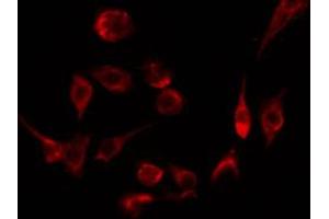 ABIN6274544 staining Hela by IF/ICC. (STAG3 抗体  (C-Term))