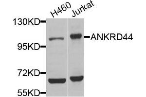 Western blot analysis of extracts of H460 and Jurkat cells, using ANKRD44 antibody. (ANKRD44 抗体)