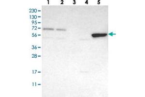 Western blot analysis of Lane 1: RT-4, Lane 2: U-251 MG, Lane 3: Human Plasma, Lane 4: Liver, Lane 5: Tonsil with FAM73A polyclonal antibody  at 1:250-1:500 dilution. (FAM73A 抗体)