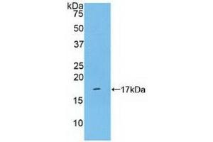 Detection of Recombinant KLRB1, Human using Polyclonal Antibody to Cluster Of Differentiation 161 (CD161) (CD161 抗体  (AA 73-188))