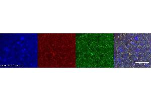 Immunohistochemistry (IHC) image for anti-Dopa Decarboxylase (Aromatic L-Amino Acid Decarboxylase) (DDC) antibody (ABIN7456246) (DDC 抗体)