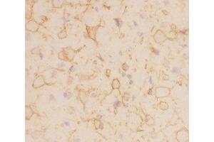 IHC-F staining of rat brain tissue (Kv2.1/KCNB1 抗体  (AA 687-858))