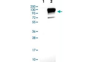 Western blot analysis of Lane 1: Negative control (vector only transfected HEK293T lysate) Lane 2: Over-expression lysate (Co-expressed with a C-terminal myc-DDK tag (~3. (Neuroligin 3 抗体)