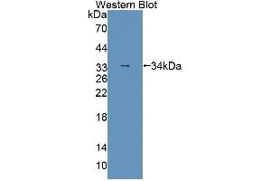 Western blot analysis of the recombinant protein. (THYN1 抗体  (AA 1-225))