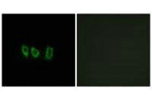 Immunofluorescence analysis of A549 cells, using CSTL1 antibody. (CSTL1 抗体)