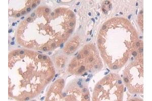 DAB staining on IHC-P; Samples: Human Kidney Tissue (DGKE 抗体  (AA 243-502))