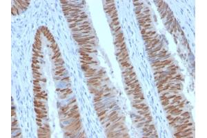 Immunohistochemistry (IHC) image for anti-Caudal Type Homeobox 2 (CDX2) (AA 150-249) antibody (ABIN6939060)