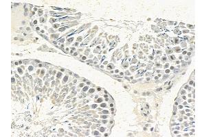 hnRNP C1/C2 Mouse Monoclonal Antibody at 1/100 staining rat testis tissue by IHC-P.