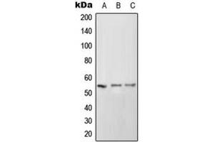 Western blot analysis of CD102 expression in HeLa (A), SP2/0 (B), PC12 (C) whole cell lysates. (ICAM2 抗体  (Center))