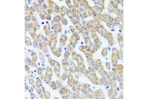 Immunohistochemistry of paraffin-embedded human liver injury using INADL antibody at dilution of 1:100 (x40 lens). (PATJ 抗体)