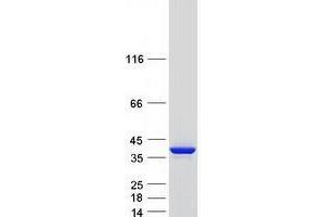 Western Blotting (WB) image for Tropomyosin 1 (Alpha) (TPM1) (Transcript Variant 5) protein (Myc-DYKDDDDK Tag) (ABIN2734382)