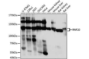 Western blot analysis of extracts of various cell lines, using RNF20 antibody (ABIN7270072) at 1:1000 dilution. (RNF20 抗体  (AA 1-260))