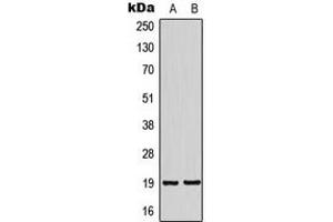Western blot analysis of NSG2 expression in SHSY5Y (A), HeLa (B) whole cell lysates. (NSG2 抗体  (Center))