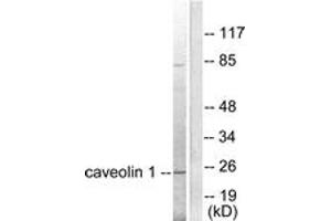 Western blot analysis of extracts from HuvEc cells, using Caveolin-1 Antibody.