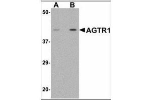 Western blot analysis of AGTR1 in mouse kidney tissue lysate with AGTR1 antibody at (A) 1 and (B) 2 µg/ml. (Angiotensin II Type-1 Receptor 抗体)