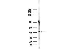 Western blot analysis of lysates from EC304 cells, using GPR175 Antibody at 1/1000 dilution.