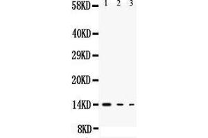 Anti-IL3 antibody, Western blotting All lanes: Anti IL3  at 0. (IL-3 抗体  (Middle Region))