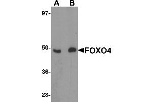 Western Blotting (WB) image for anti-Forkhead Box O4 (FOXO4) (N-Term) antibody (ABIN1031385) (FOXO4 抗体  (N-Term))