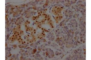 IHC image of ABIN7127582 diluted at 1:100 and staining in paraffin-embedded human pancreatic tissue performed on a Leica BondTM system. (Recombinant ISL1 抗体)
