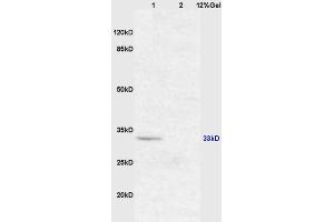 Lane 1: mouse brain lysates Lane 2: mouse intestine lysates probed with Anti XAF1/FBXO39 Polyclonal Antibody, Unconjugated (ABIN674754) at 1:200 in 4 °C. (XAF1 抗体  (AA 151-250))