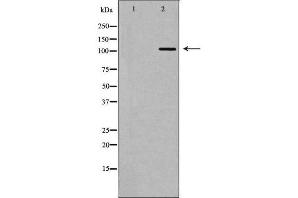 IFIH1 抗体  (C-Term)