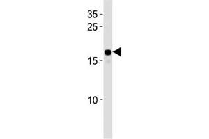 HMGA2 antibody western blot analysis in HepG2 lysate. (HMGA2 抗体  (AA 64-92))